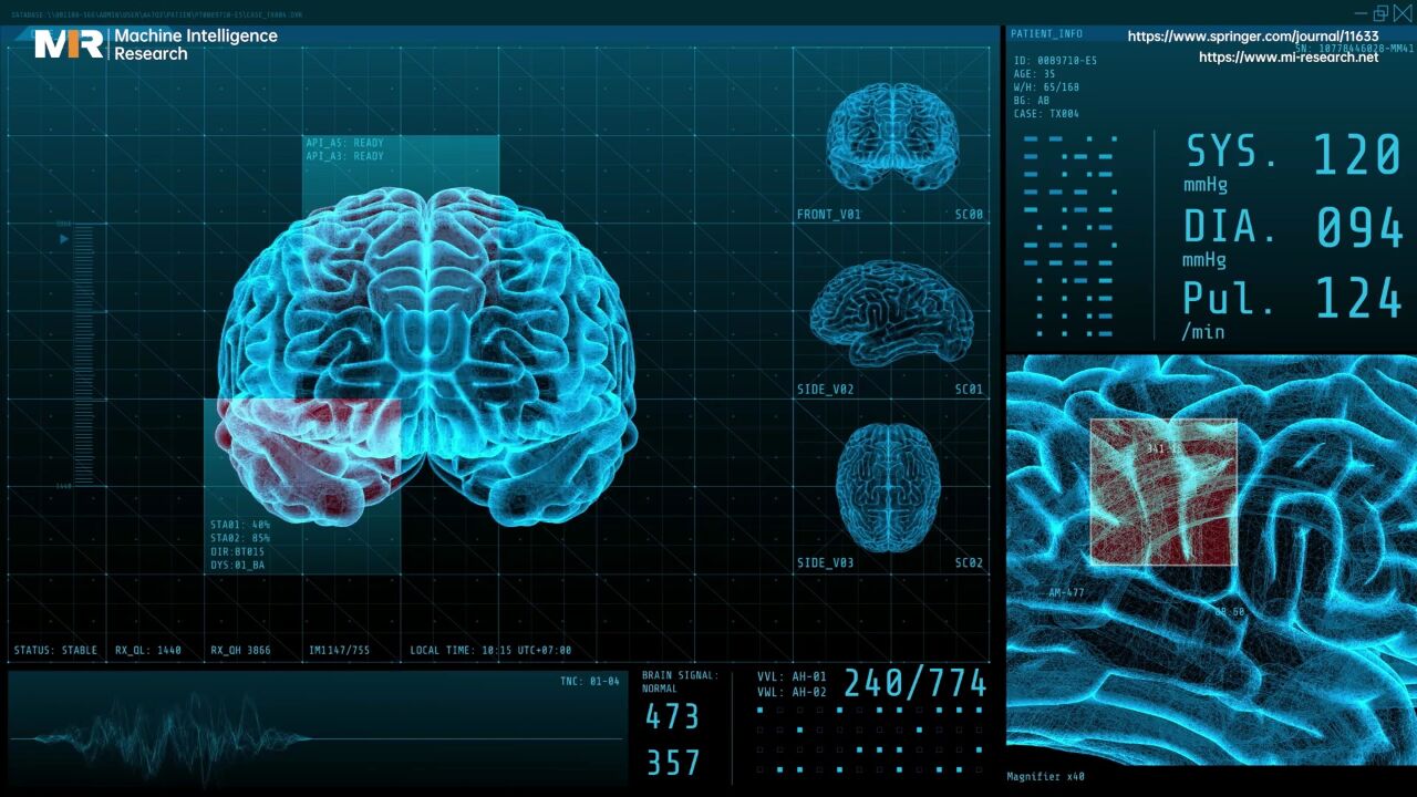 【90s解读AI】欧洲科学院院士蒋田仔团队 | 脑成像数据的多模态融合: 方法与应用