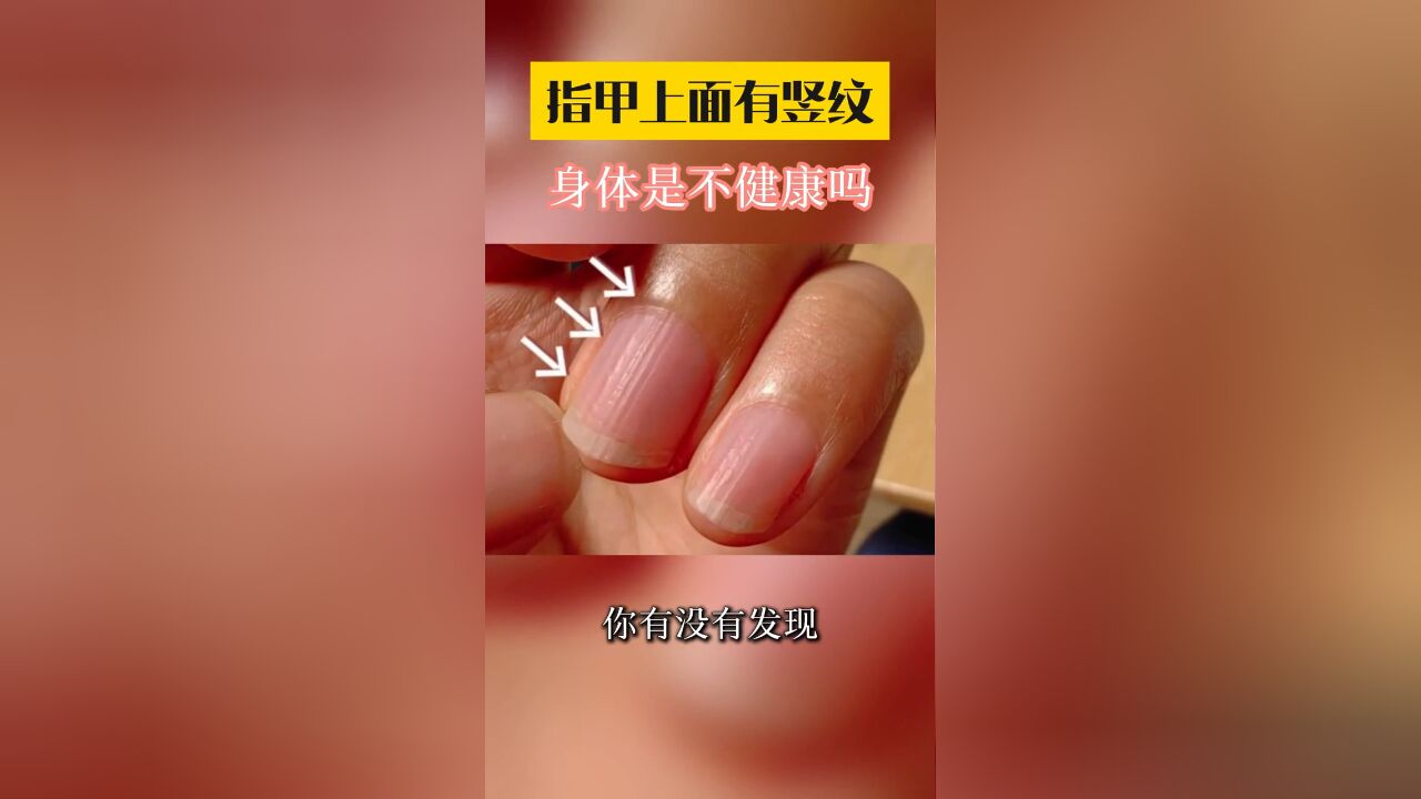 注意看!你的指甲上有没有这种竖纹?这是身体出问题了吗?