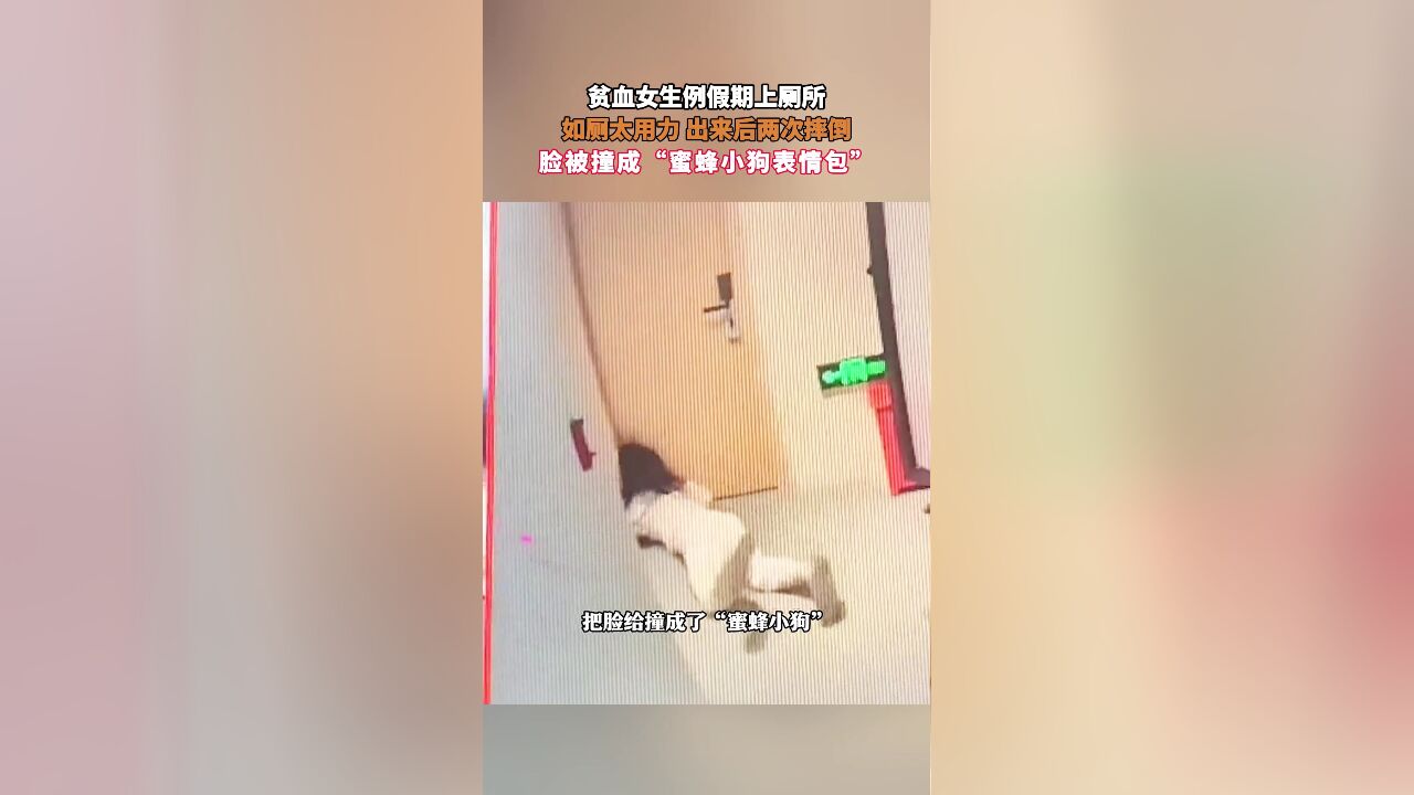 贫血女生例假期上厕所,如厕太用力 出来后两次摔倒,脸被撞成“蜜蜂小狗表情包”