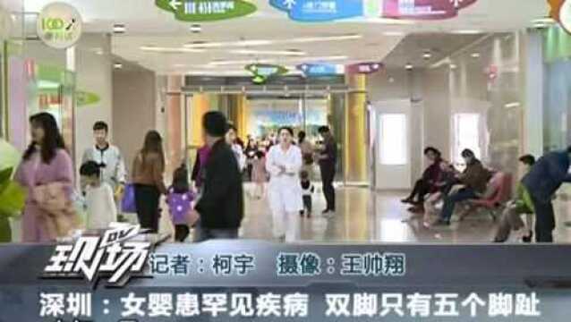 深圳:女婴患罕见疾病 双脚只有五个脚趾