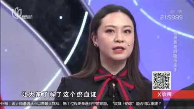 不良生活习惯对身体有巨大影响,长期久坐久站,易引起静脉栓塞!