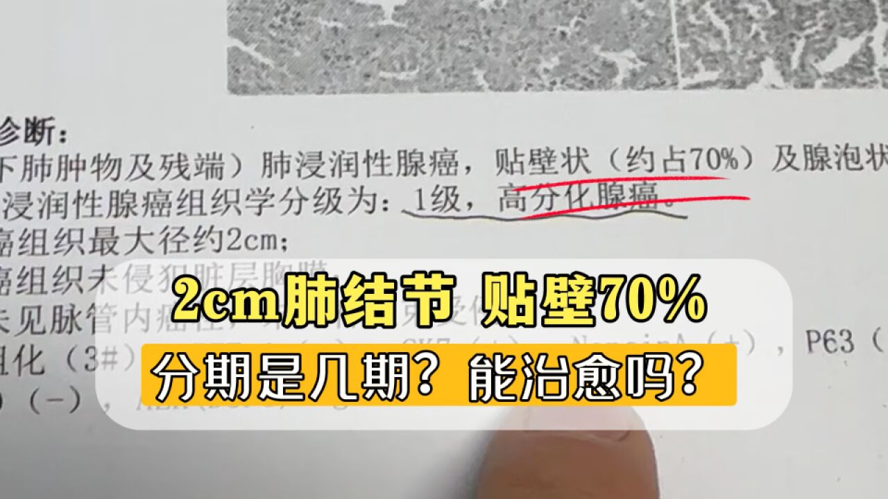 2cm肺结节,贴壁70%术后能治愈吗?解读病理报告