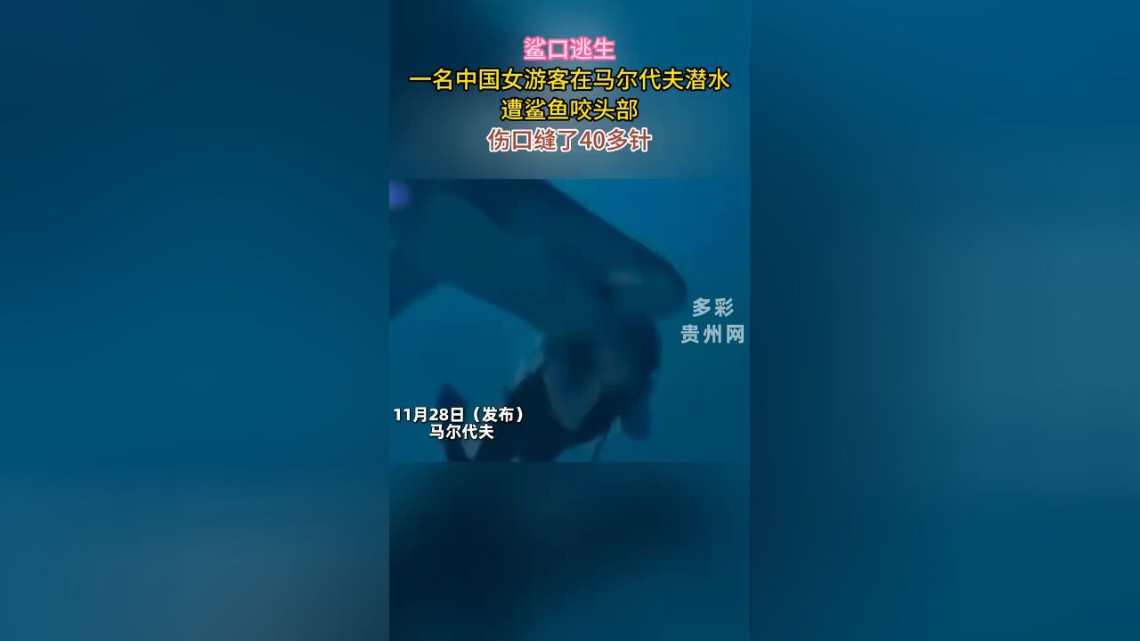 鲨口逃生 一名中国女游客在马尔代夫潜水 遭鲨鱼咬头部 伤口缝了40多针