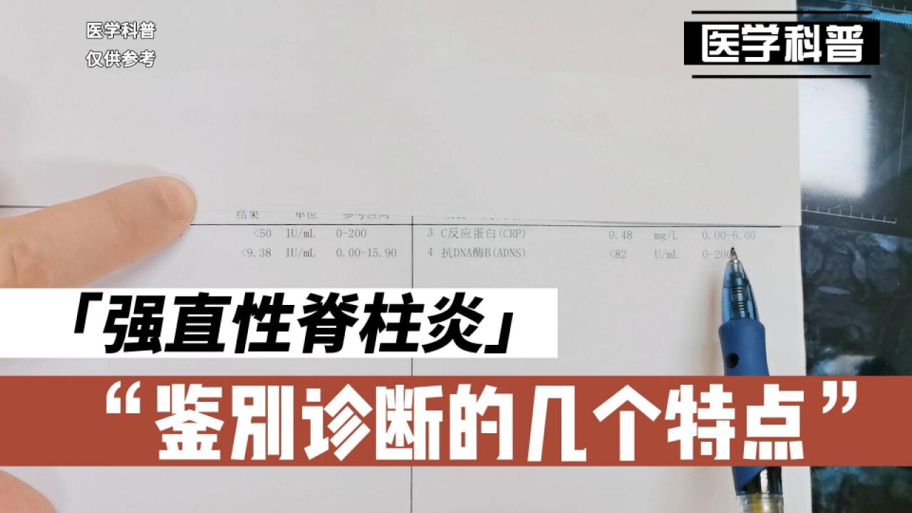 强直性脊柱炎鉴别诊断的有哪几个重要特点呢,听听肖医生怎么说