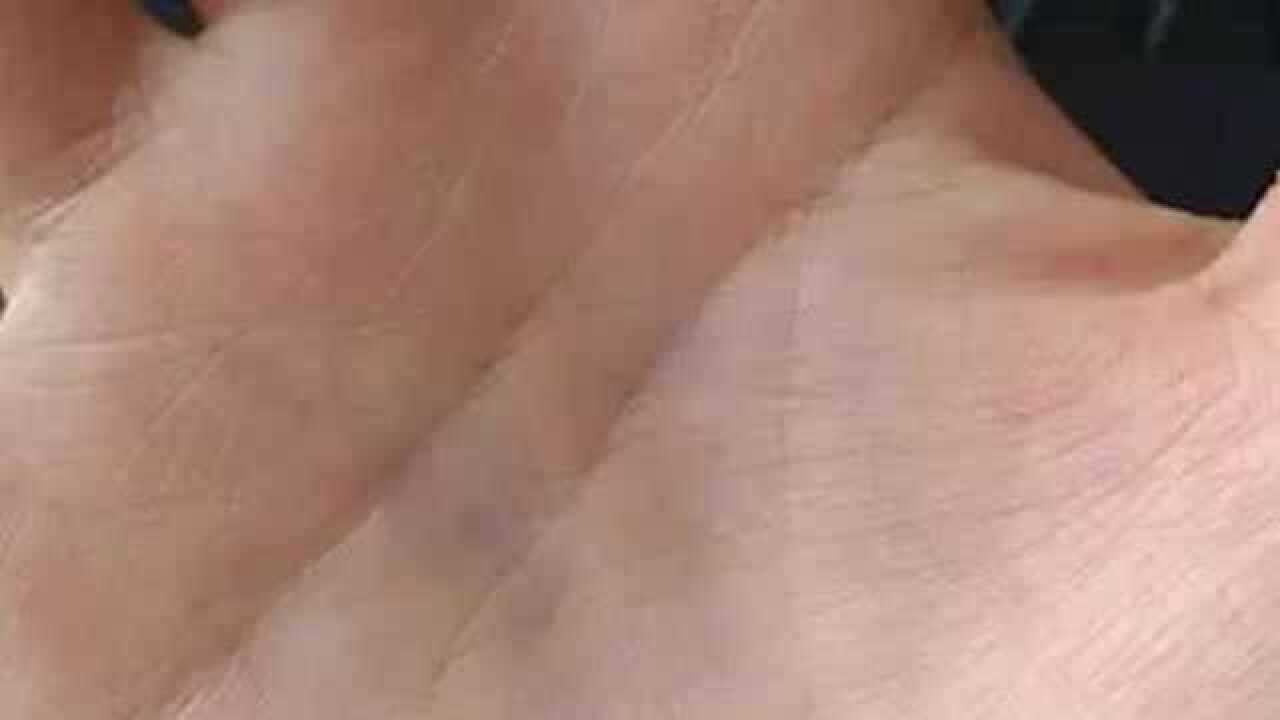 元宝纹手相图片 腾讯网