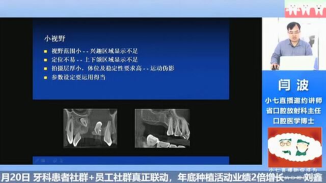 浅谈如何用好CBCT 闫波节选