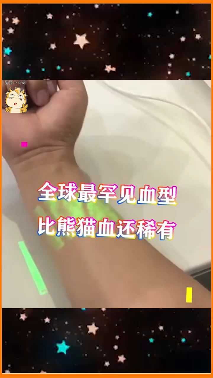 全球最罕见的血型比熊猫血都稀有可治疗任何人