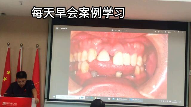 雅贝康每日学习