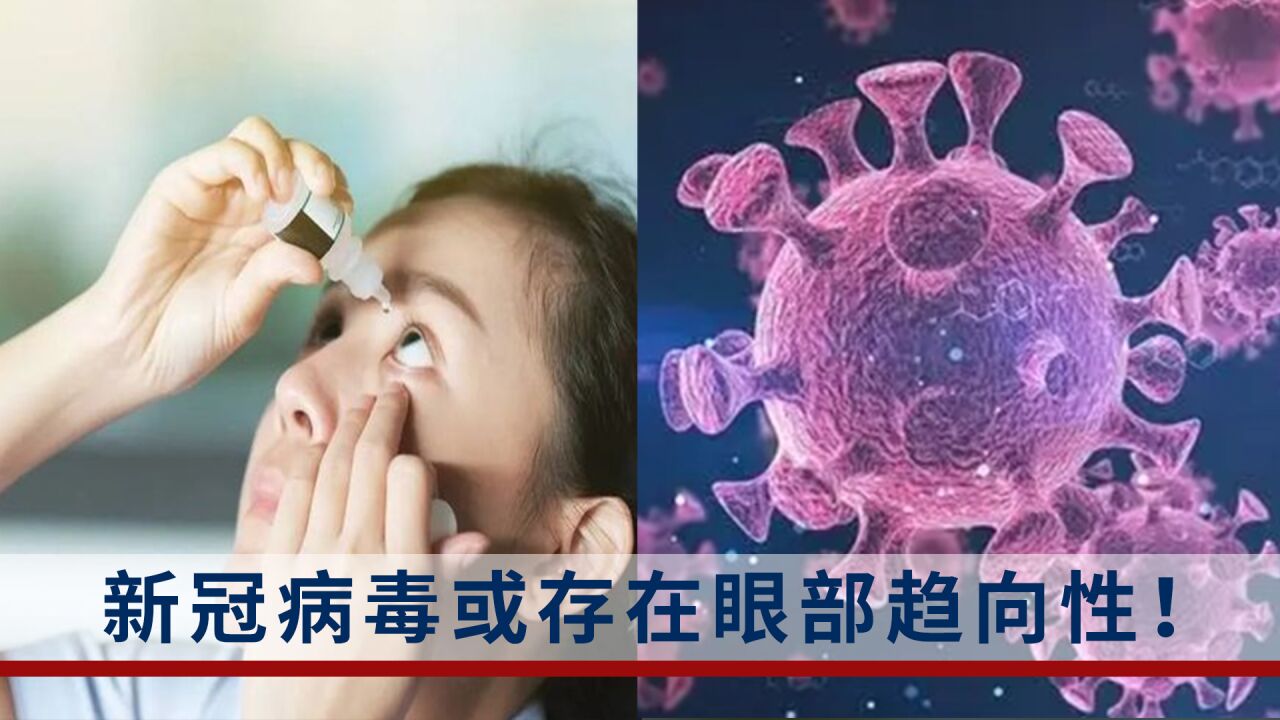 新冠病毒或存在眼部趋向性,医生:眼部感染最易发生在新冠感染后15天至2个月