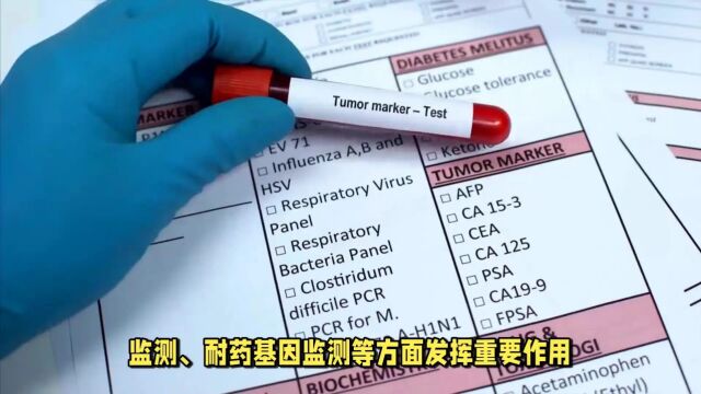 天烁生物丨CTC检测手段更早、更灵敏发现肿瘤的变化