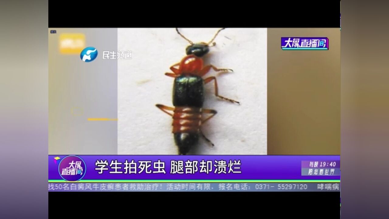 学生拍死虫,腿部却溃烂