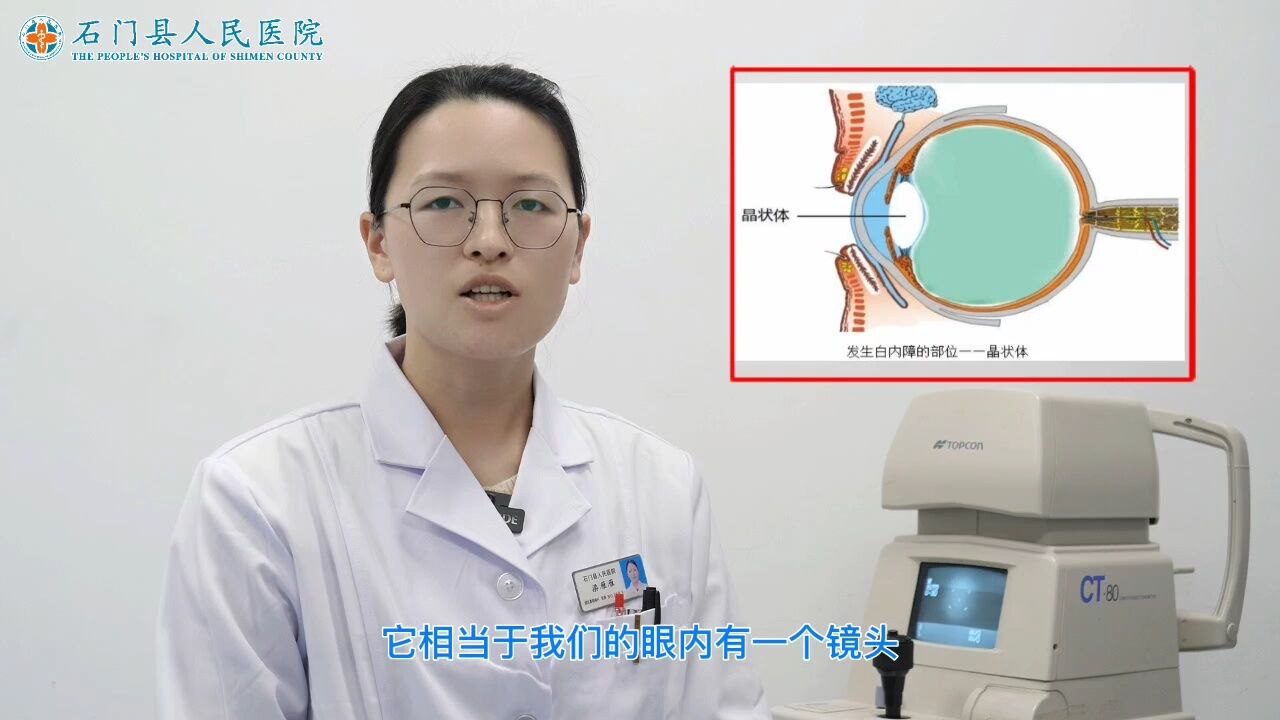 白内障到底是怎么回事?其实很简单,看完这个视频都能懂