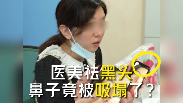 祛黑头鼻子竟被吸塌了?曾宁:鼻子不是纸做的,力量再大也不可能