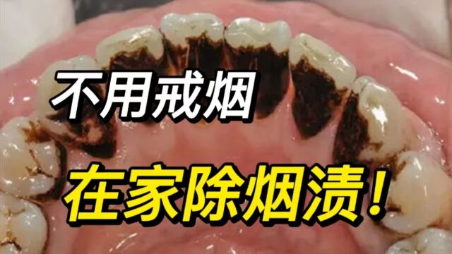 如何去除烟渍牙?!只需做到这几点,烟牙分分钟亮白!