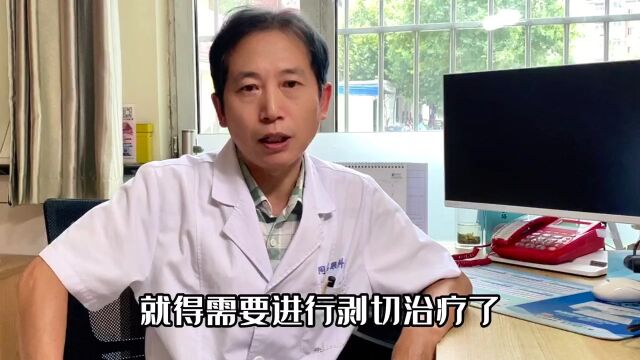 衡水同瑞眼科席建松医生:糖尿病视网膜病变——最根本的方式是科学控制糖尿病!