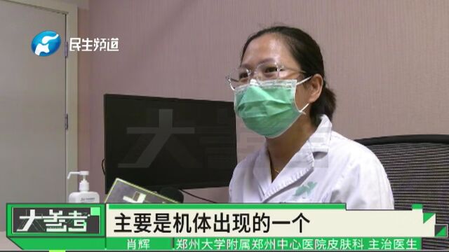 13岁男孩一打篮球就浑身瘙痒难耐起红疹,医生诊断为“运动性荨麻疹”!