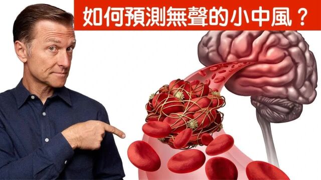 预测无症状小中风,5个主要因素,自然疗法,柏格医生 Dr Berg