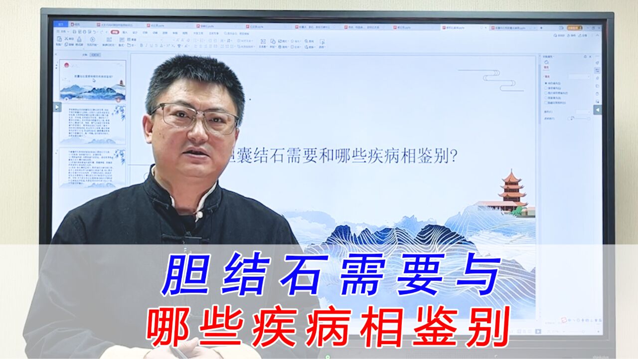 胆结石需要与哪些疾病相鉴别,容易与这四类疾病混淆