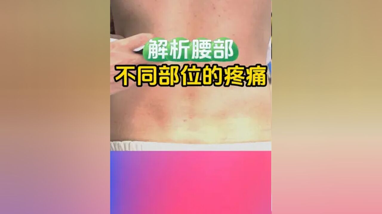 解析腰部不同部位的疼痛#硬核健康科普行动