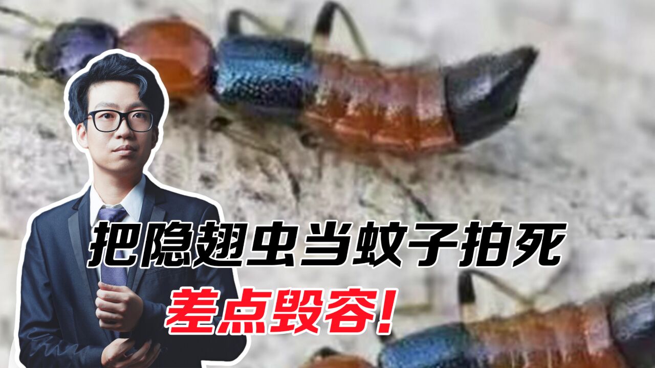 把隐翅虫当蚊子拍死,差点毁容!小小虫子竟然这么“毒”?