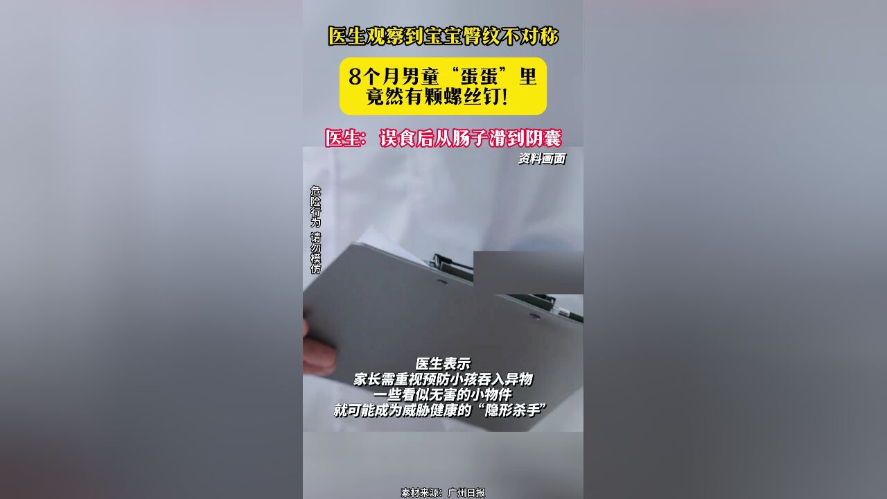 医生观察到宝宝臀纹不对称 8个月男童“蛋蛋”里竟然有颗螺丝钉!医生:误食后从肠子滑到阴囊