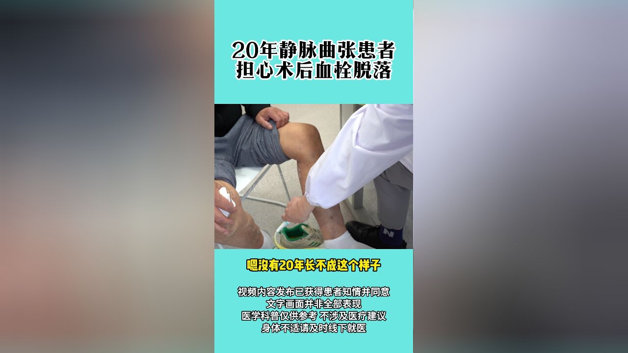 20年“蚯蚓腿”患者 担心术后血栓脱落!