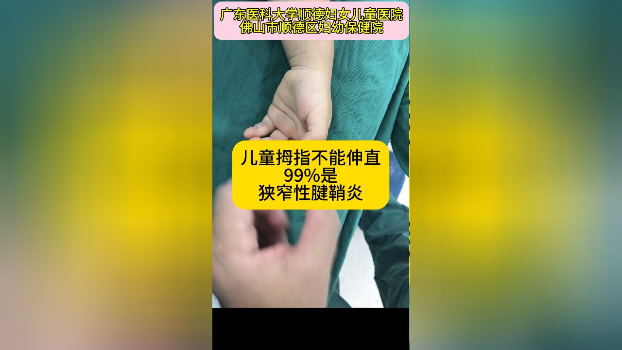 儿童狭窄性腱鞘炎,多见于1岁左右儿童,表现为拇指不能主动伸直,用力掰直拇指时可有弹响,掌指关节处可触及硬节.