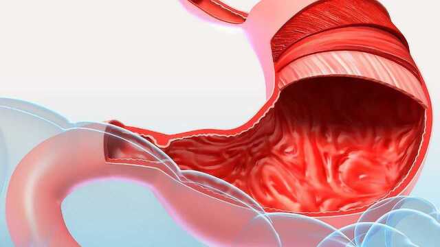 哪些因素会造成胃下垂?注意这些造成胃下垂的原因
