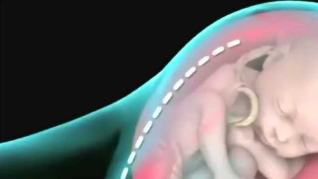 3D动画演示:剖腹产的过程