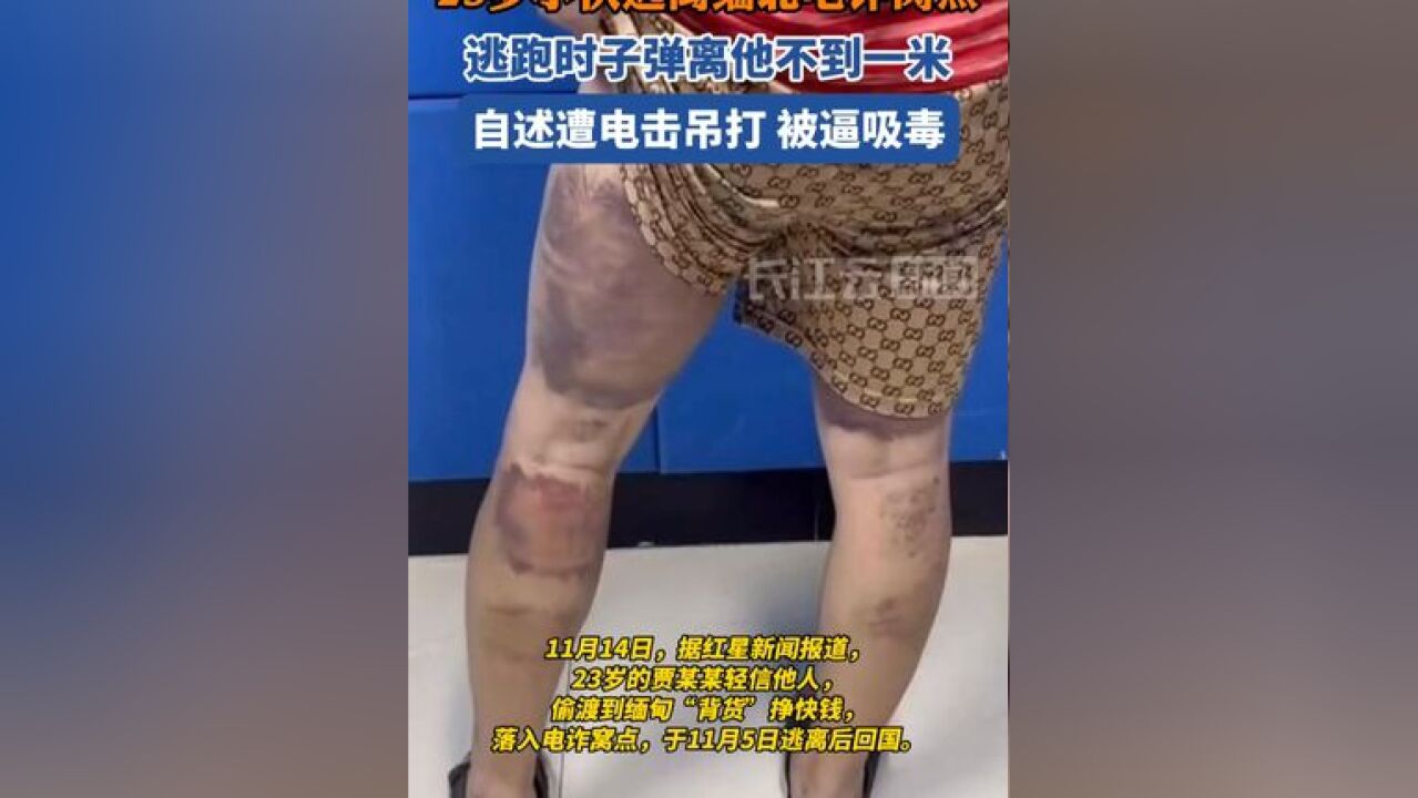 23岁小伙自述逃离缅北经历:逃跑时子弹离他不到一米远