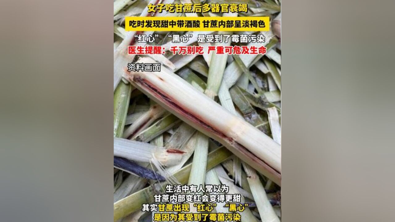 女子吃甘蔗后多器官衰竭,吃时发现甜中带酒酸甘蔗内部呈淡褐色 医生:千万别吃,严重可危及生命!