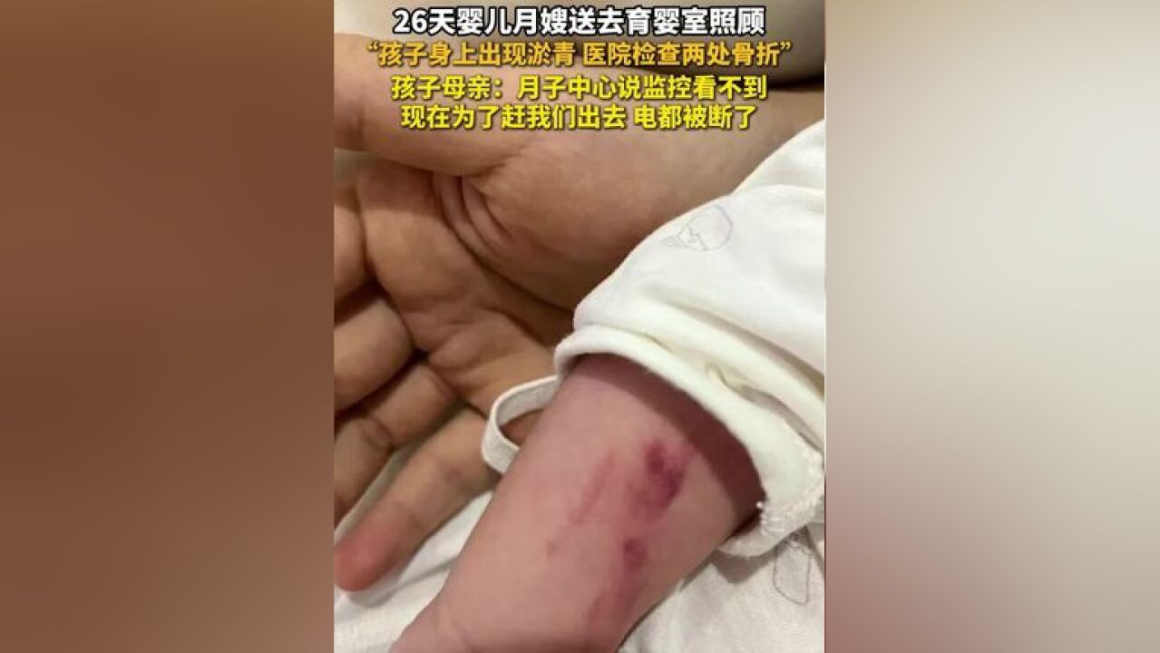 26天婴儿月嫂送去育婴室照顾 “孩子身上出现淤青 医院检查两处骨折”孩子母亲:月子中心说监控看不到 现在为了赶我们出去