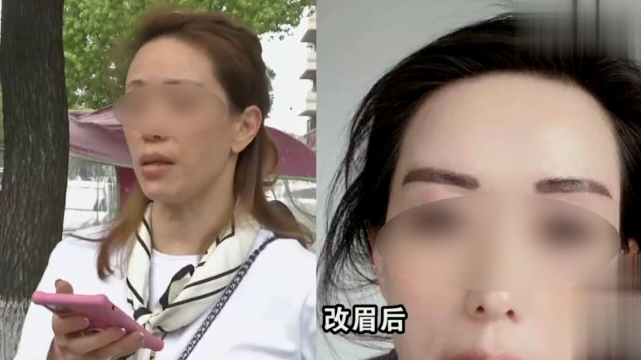 女子花6万纹眉,纹后如“2把大刀”高低不平,再花3.9万效果更差