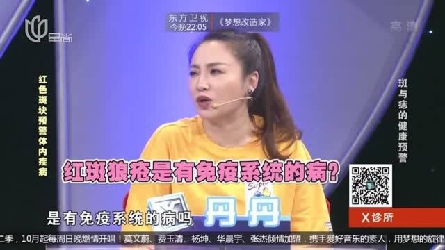 红斑狼疮是免疫系统病吗?对哪些部位有影响?身体预警别忽视