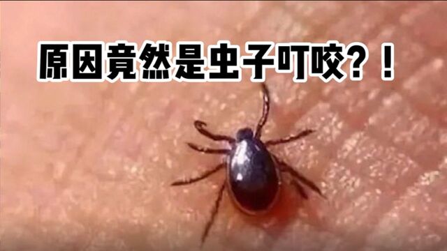 恙虫病是什么?感染恙虫病如何应对?