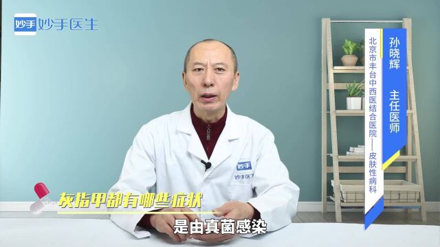 灰指甲到底是什么病?都有哪些症状?医生来解答