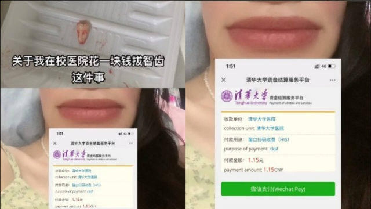 清华女学生拔智齿费用近千元,报销后仅需1元,网友:缺通知书