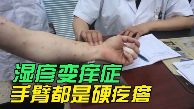 密集恐惧症慎入!30岁男子手臂爬满密密麻麻的“小虫子”