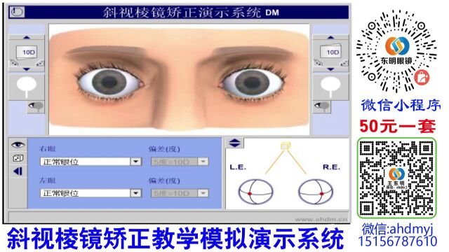 斜视棱镜视频教材