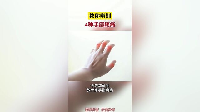 教你辨别4种手部疼痛