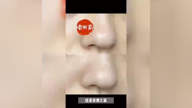 #生美汇优选#轻医美#合伙人#美容院 如何做资源整合,如何让顾客主动转介绍客户,如何开发新资源 如何做顾客管理 如何做医美团队管理 快速加入生美汇优...