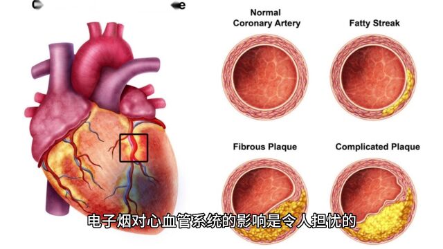 为什么电子烟比普通香烟更危险?科学家的警告!