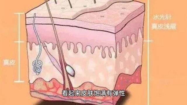 打完水光针几天效果达到最好、打完水光针要反黑几天?