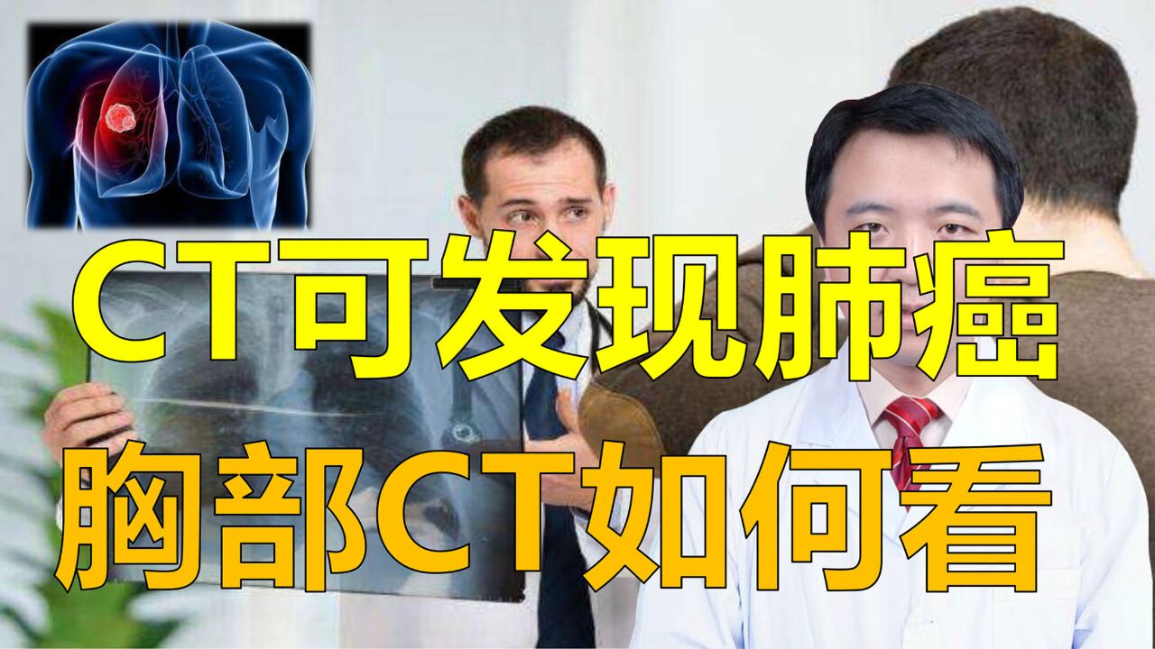 胸部CT可以发现肺结节、肺癌,如何看?胸外科专家亲自教你