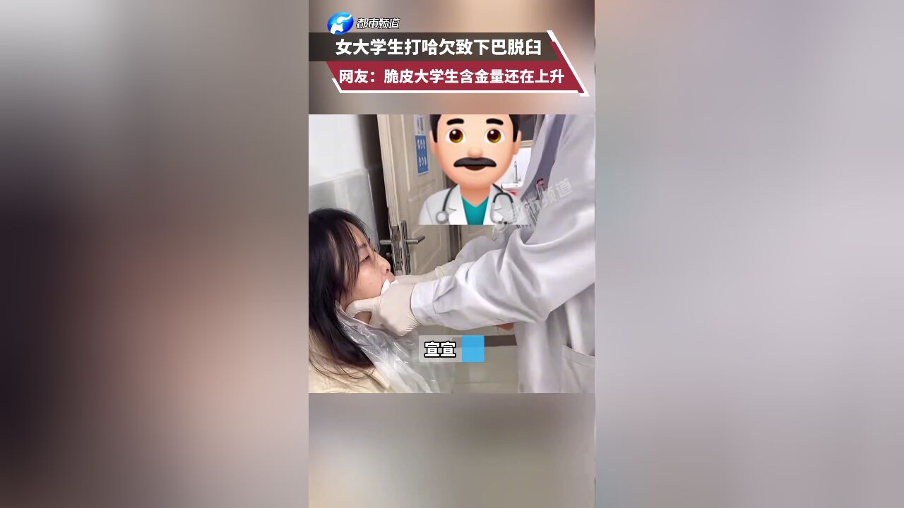 女大学生打哈欠致下巴脱臼 网友:脆皮大学生含金量还在上升