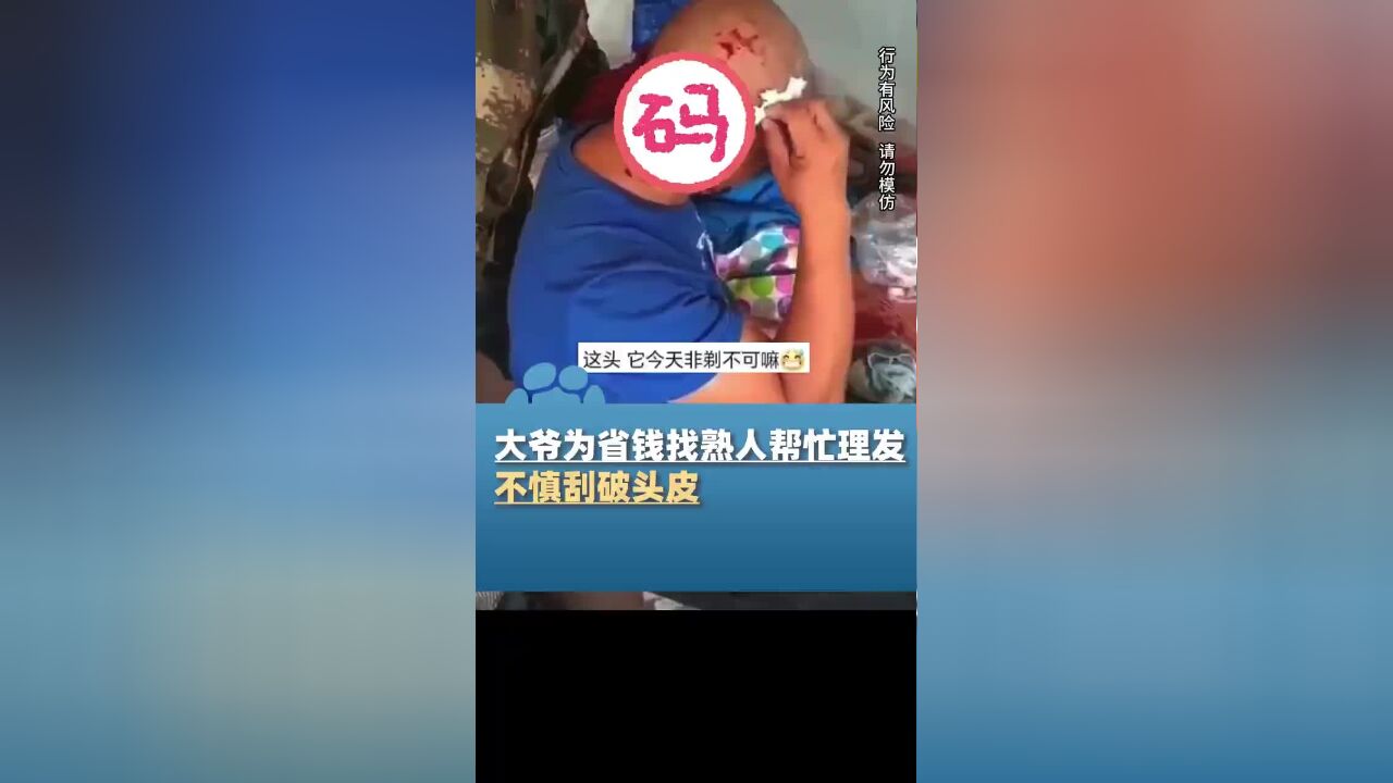 大爷为省钱找熟人帮忙理发,不慎刮破头皮