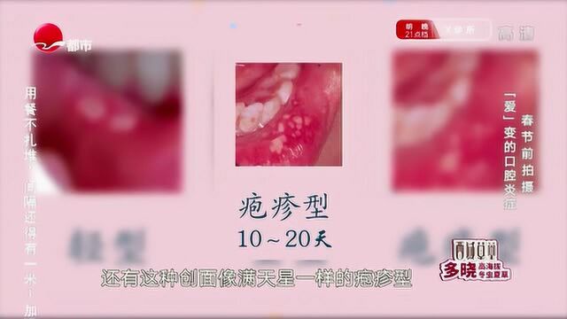 3种常见的口腔炎症溃疡症状,你还觉得只是小问题吗?