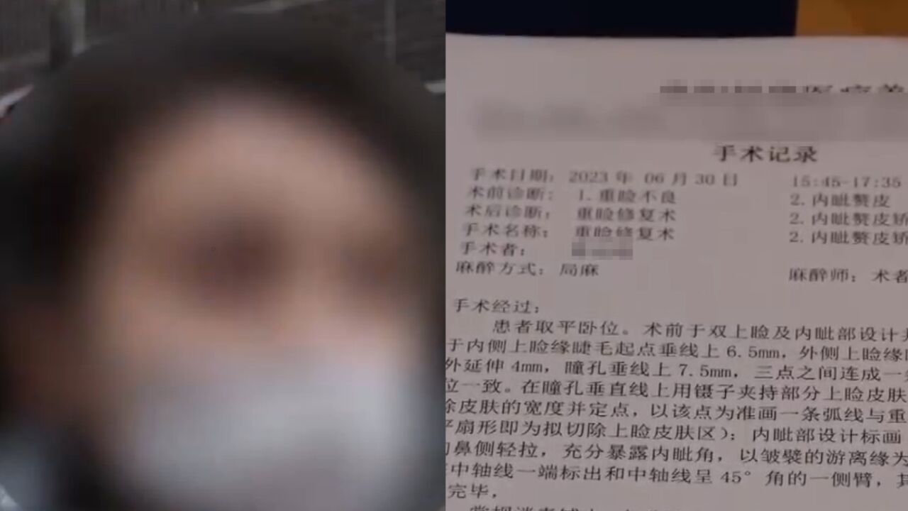 女主播花5000元做整形,术后变“大小眼”,美容机构:手术没问题