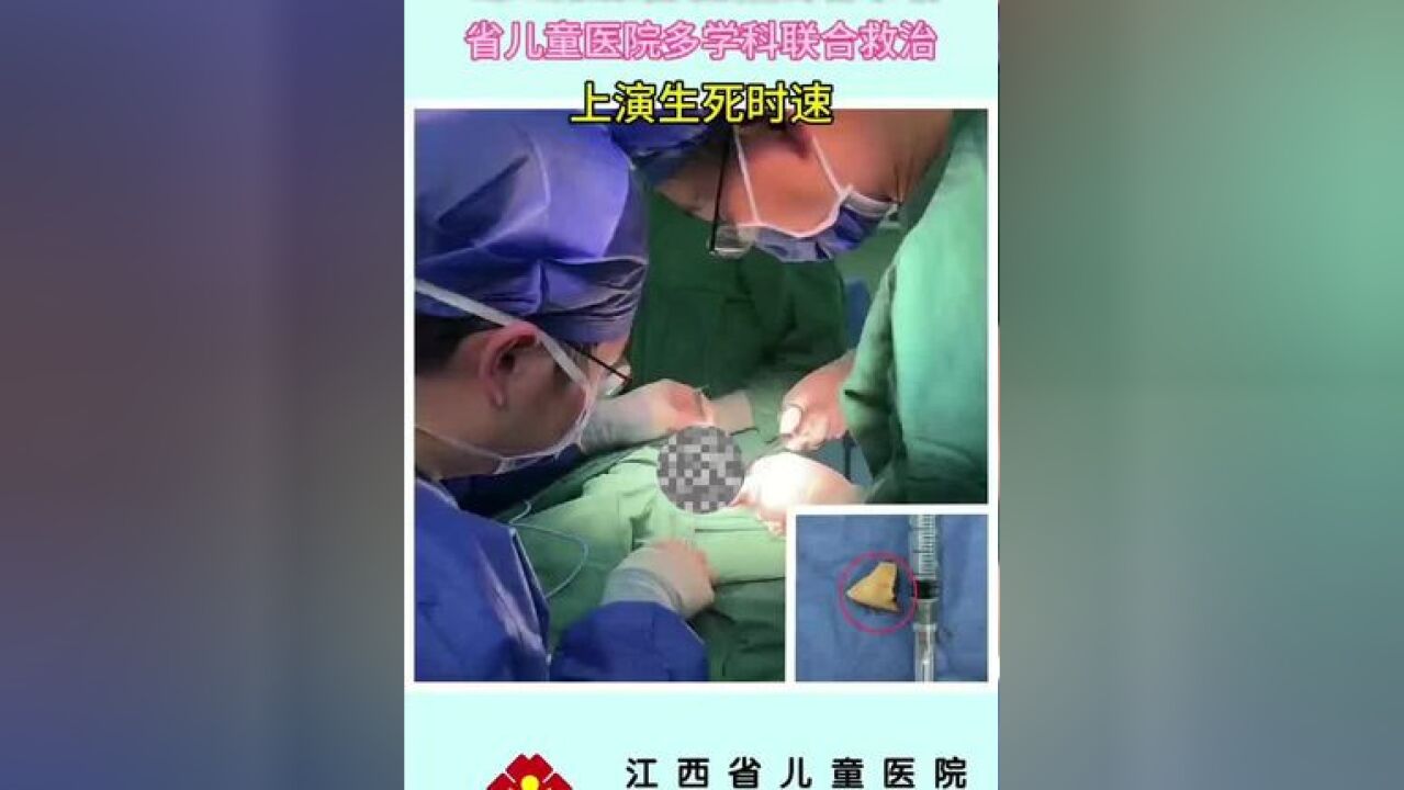 1岁2月龄幼儿误吞碎骨卡喉 省儿童医院多学科联合救治上演“生死时速”