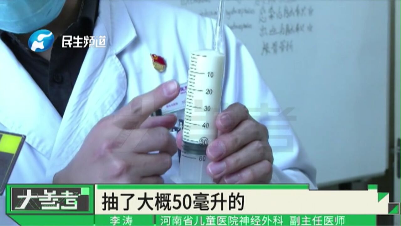 河南郑州:男孩头部剧痛,颅中抽出“牛奶”?诊疗为脑脓肿!